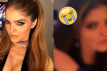 Ana Barbara se opera la nariz porque la odiaba, y este es el resultado