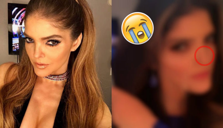 anabarbara nariz