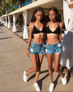 obligaron a estas modelos rusas de 14 años a adelgazar tienen anorexia ahora están al borde de la muerte