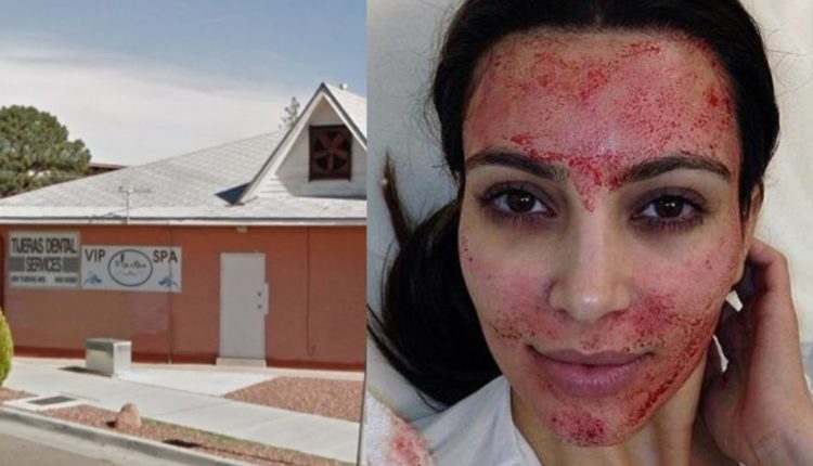 facial vampiro (1)